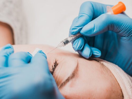 Milia Extraction – Divine Aesthetics & Laser Clinic